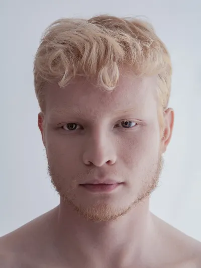 Color high-key portrait of a young man with strawberry-blond curly hair and freckles